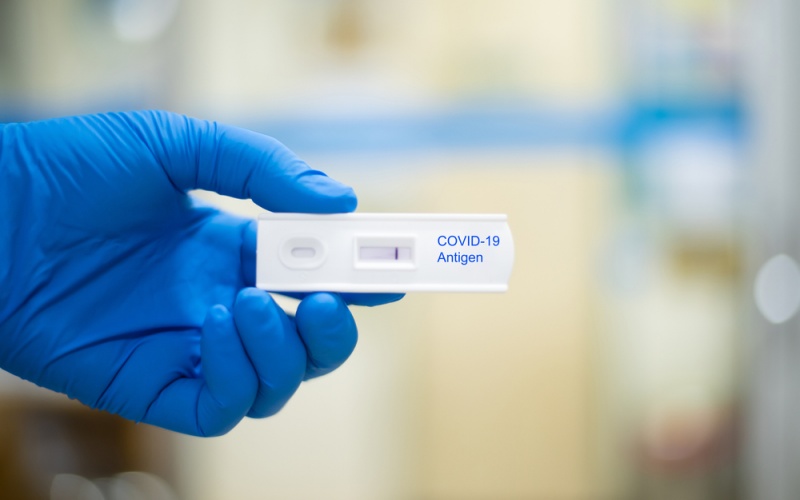antigen test