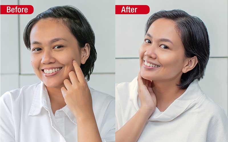 Before After Femina Review SK-II Genoptic Aura Essence dan Pitera Facial Treatment Essence