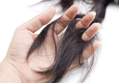Atasi Rambut Rontok