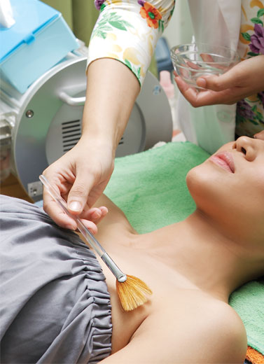 Stretchmark di Payudara