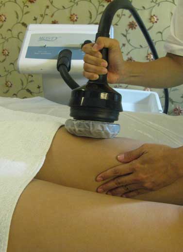 Body Shaping with Botanical Extract