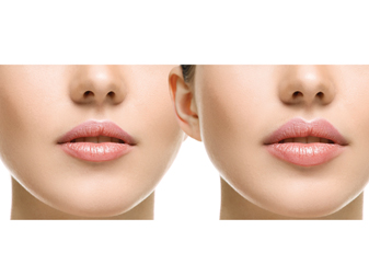 Tren Sulam Bibir