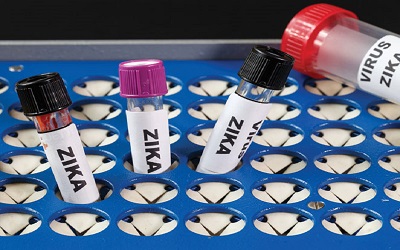 Setelah Singapura, Kini Thailand Terancam Virus Zika! Ini 10 Langkah Mudah Cegah Penyebaran Virus Zika dari Rumah 
