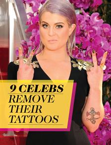 Celebs Remove Their Tattoos